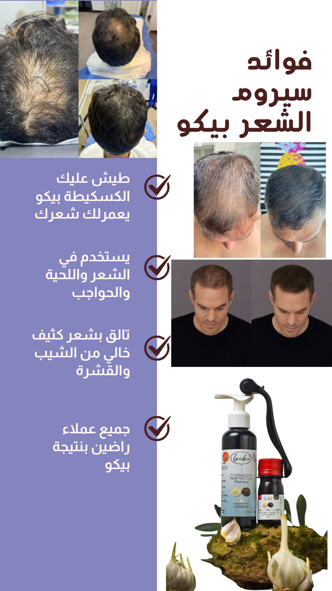 شامبو وزيت ذكر الثوم الأسود biko - Image 2